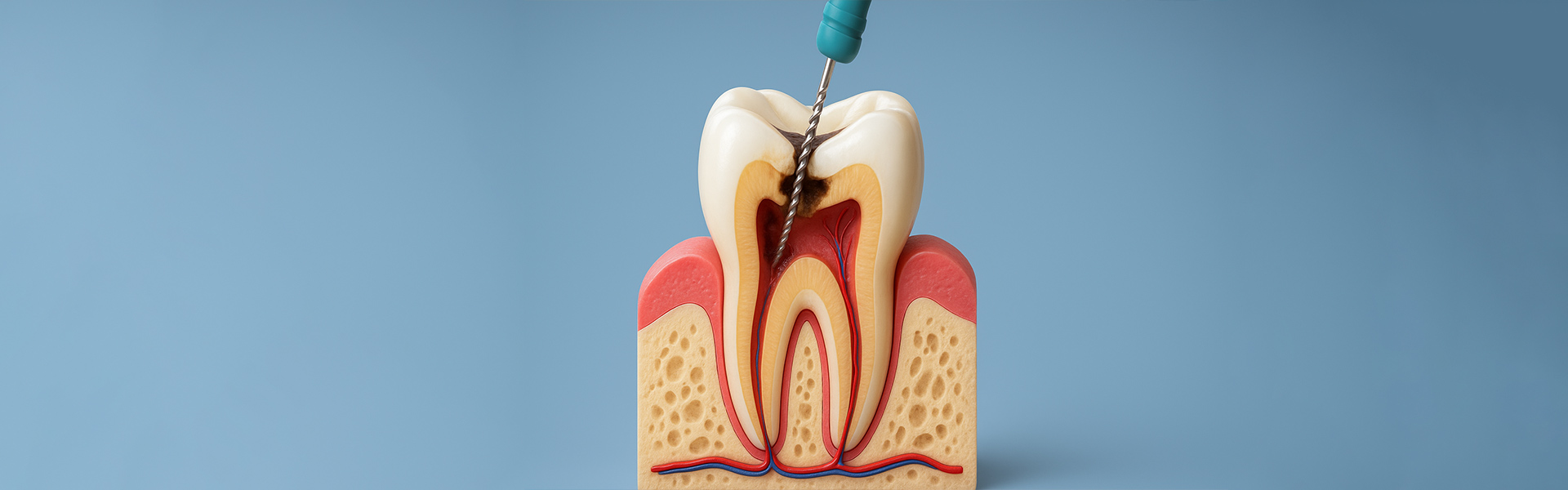 How Root Canal Treatment Helps Preserve Your Smile